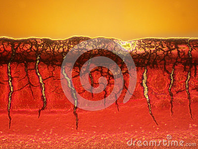 Microscopic Picture Of A Blood Clot Stock Photos   Image  27486043