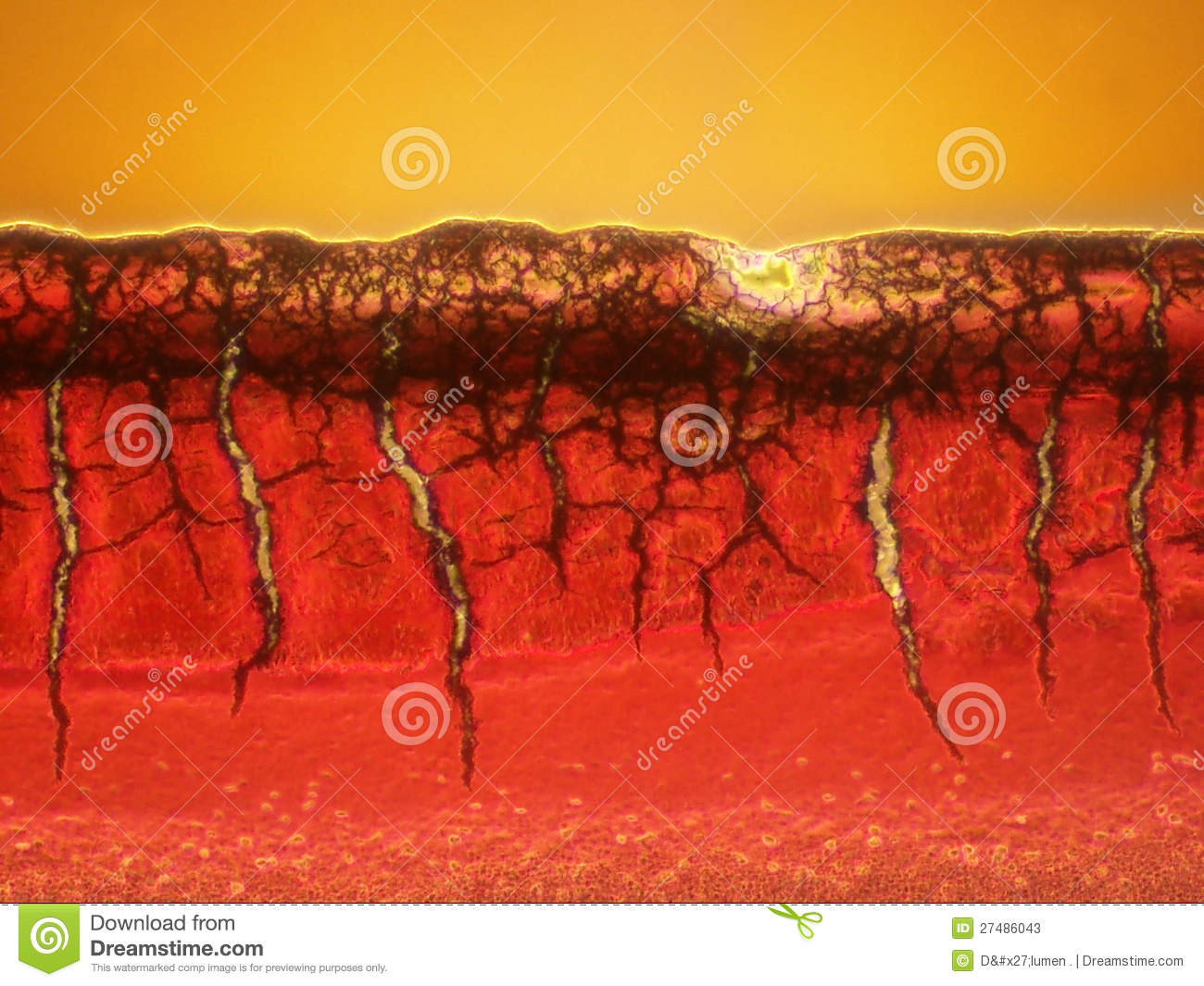 Microscopic Picture Of A Blood Clot Stock Photos   Image  27486043