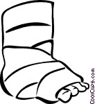 Broken Ankle Vector Clip Art