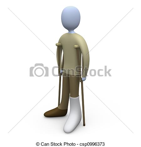Stock Illustration   Person With Broken Foot   Stock Illustration