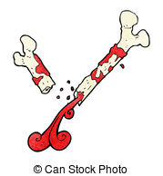 Broken Bone Vector Clipart And Illustrations