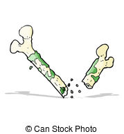 Broken Bone Vector Clipart And Illustrations