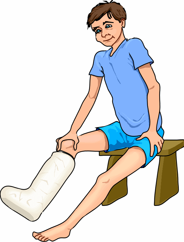 Related Pictures Broken Ankle Clip Art