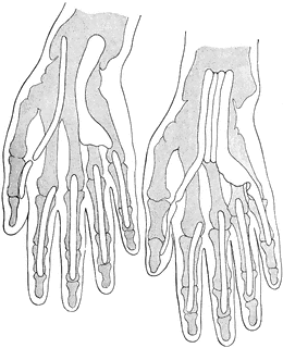 Tendon Sheaths Of Wrist And Hand   Clipart Etc