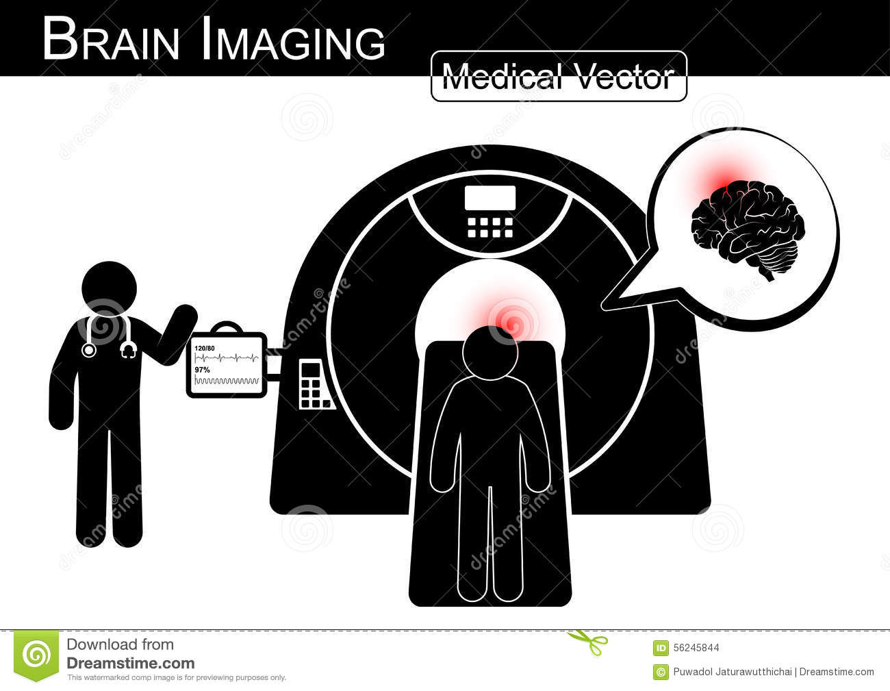Brain Disease   Hemorrhagic Or Ischemic Stroke  Brain Tumor  Brain A