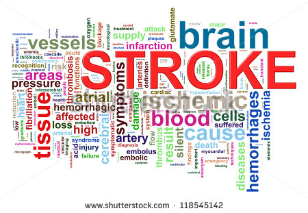 Illustration Of Brain Stroke Word Tags Wordcloud   Stock Photo