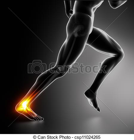 Stock Illustration Of Sports Ankle And Achilles Heel Injury Concept