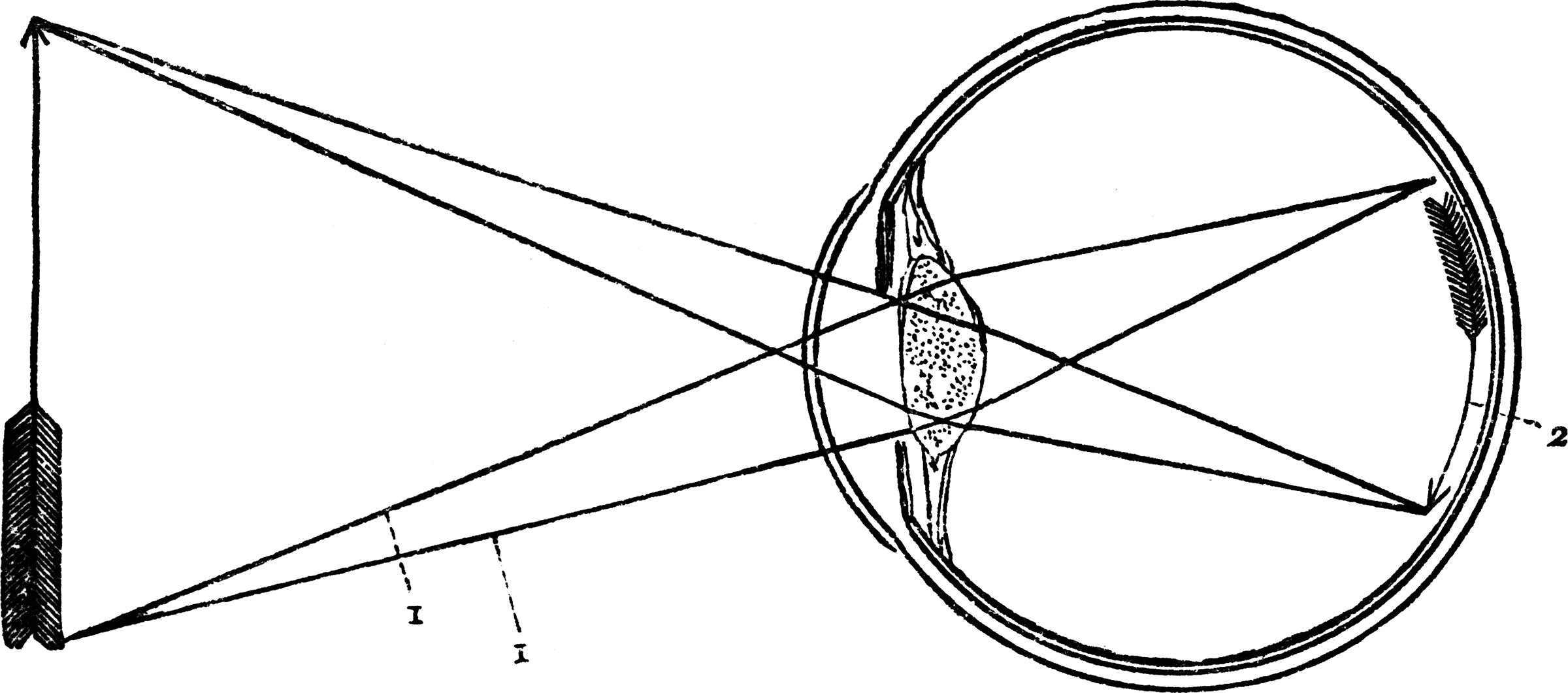 Eye Diagram   Clipart Etc