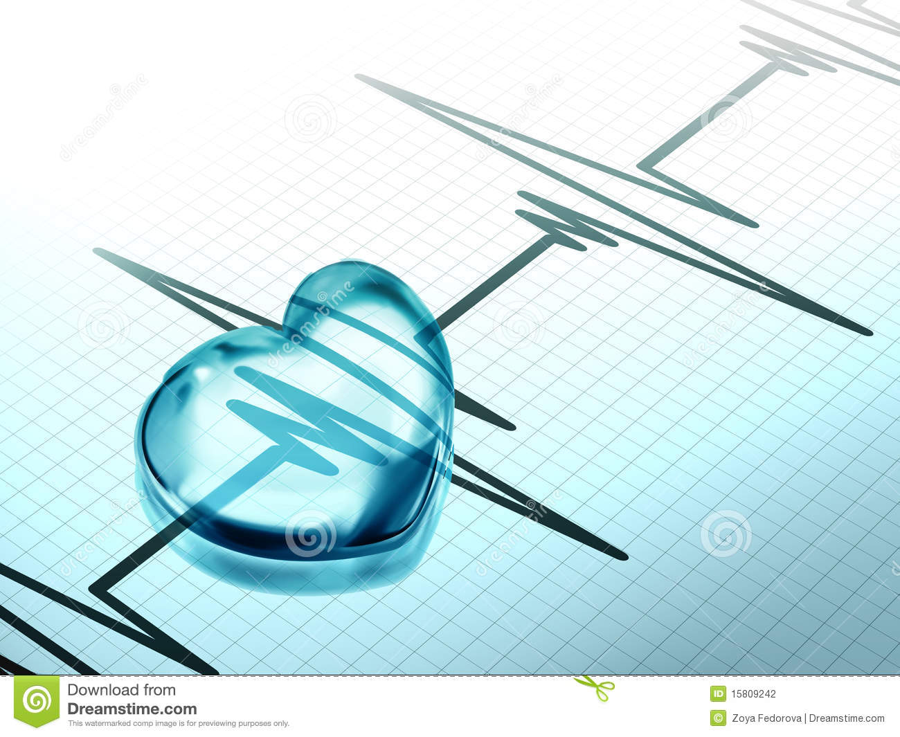 Ecg Tracing Clipart And Illustrations