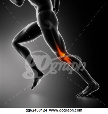 Drawing   Sports Knee Injury X Ray Concept  Clipart Drawing Gg62480124