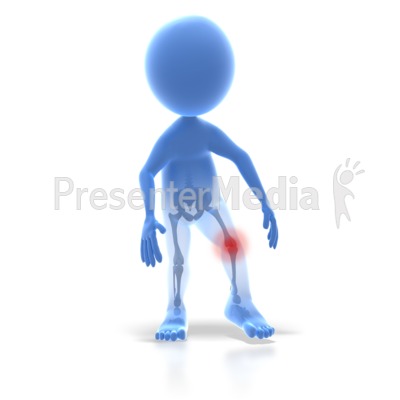 Stick Figure Knee Injury Presentation Clipart