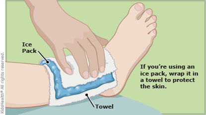 Apply Heat In Any Form For At Least 24 Hours  Heat Increases Swelling    
