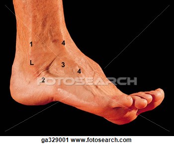At Ankle  C  Surface Anatomy Of Ankle And Foot  Observe The Swelling    