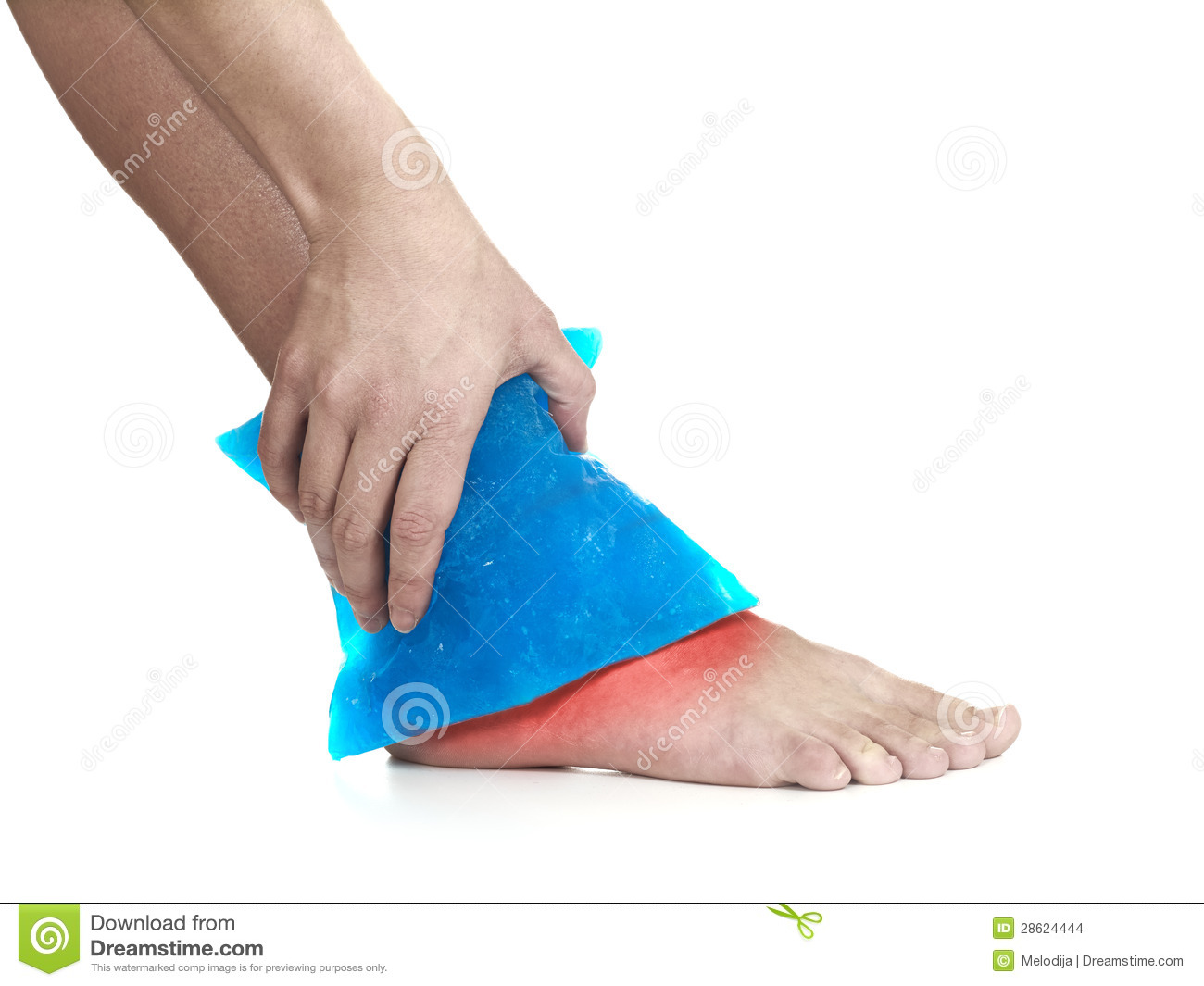 Cool Gel Pack On A Swollen Hurting Ankle  Stock Images   Image    