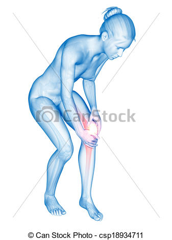 Clipart Of Knee Pain   Medical Illustration   Woman Having Pain In The