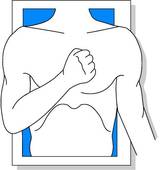 Chest Pain Illustrations And Clip Art  1411 Chest Pain Royalty Free
