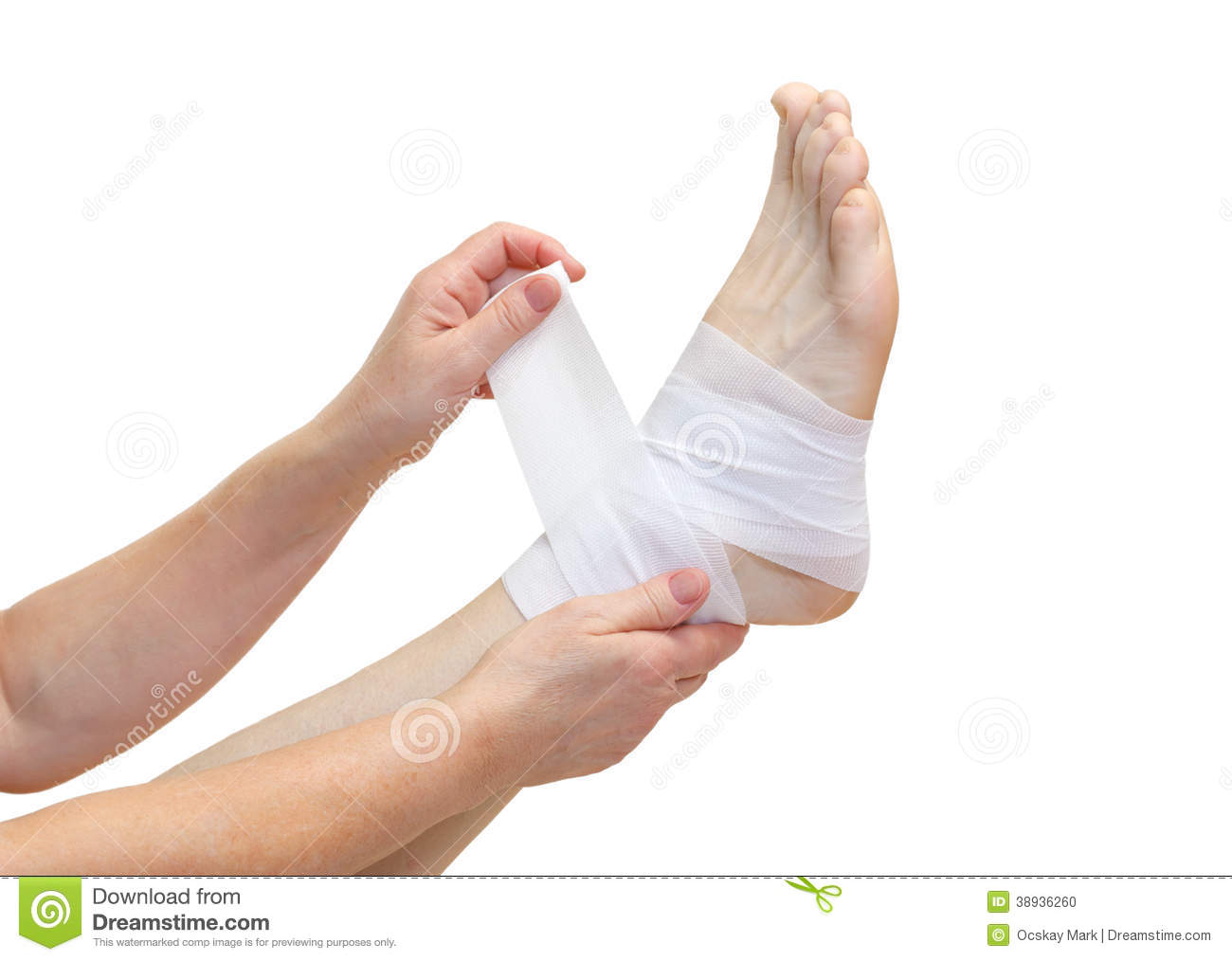 Ankle Fracture Stock Photo   Image  38936260