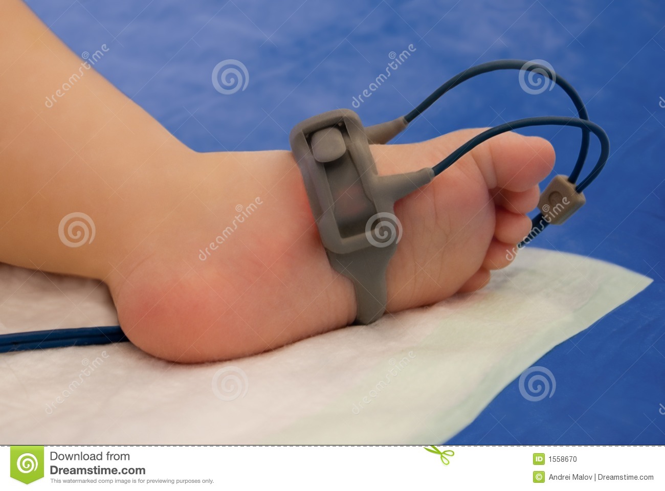 Child Foot With Oxymeter In Intensive Care Unit  15 Year Old Child 