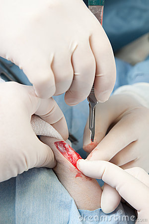 Knee Surgery Clipart