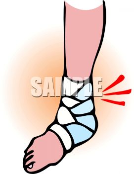 Ankle Clipart 0511 1001 2606 2415 Painful Sprained Ankle Clipart Image