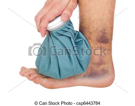 Stock Photo   Icing A Sprained Ankle   Stock Image Images Royalty