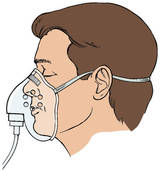 Stock Illustration Of Patient Wearing A Non Rebreathing Mask  Arrows