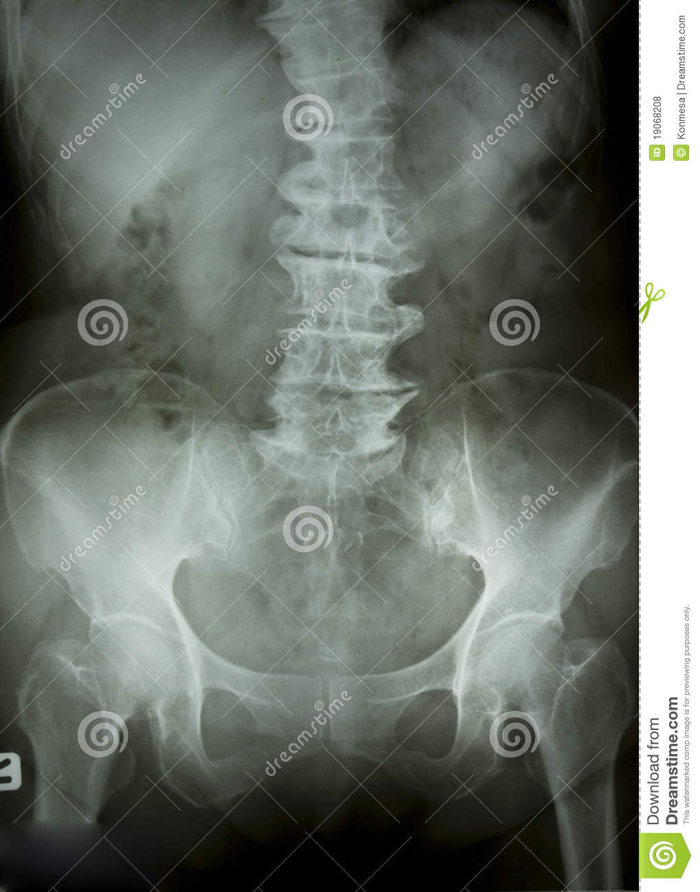 Chest X Ray Royalty Free Stock Photos   Image  19068208