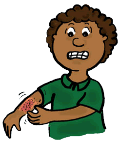 Full Version Of Itchy Rash Clipart