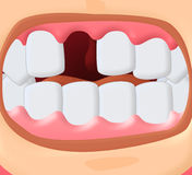 Smiley Face With A Missing Tooth Royalty Free Stock Photo   Image    