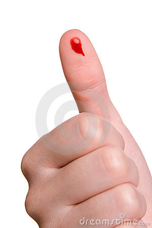Bleeding Human Thumb Closeup   Scotch