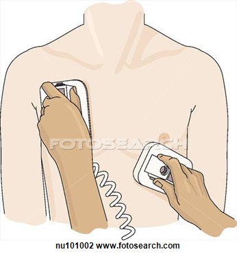 Clip Art Of Male Torso With Hands Holding Defibrillation Paddles In