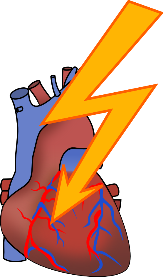 Heart Disease Clipart Heart Disease Clipart Heart Disease Clipart    