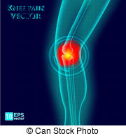 Pain Leg Clipart And Stock Illustrations  988 Pain Leg Vector Eps