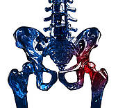Hip Pain Illustrations And Clipart