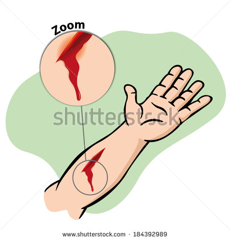 Wound Stock Photos Illustrations And Vector Art