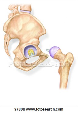 Hip Joint Lateral View  Opened  Unlabeled  Fotosearch   Search Clipart