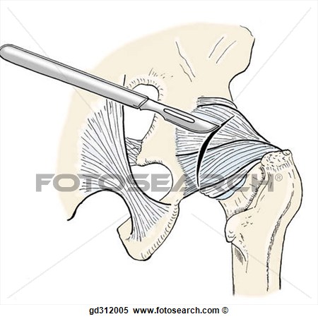 Posterior Portion Of Hip Joint   Fotosearch   Search Clipart