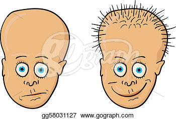 Patient With A Bald Head And Growing Hair  Clipart Drawing Gg58031127
