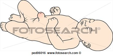Neonate Met Zichtbaar Umbilical Hernia   Fotosearch   Zoek Clipart
