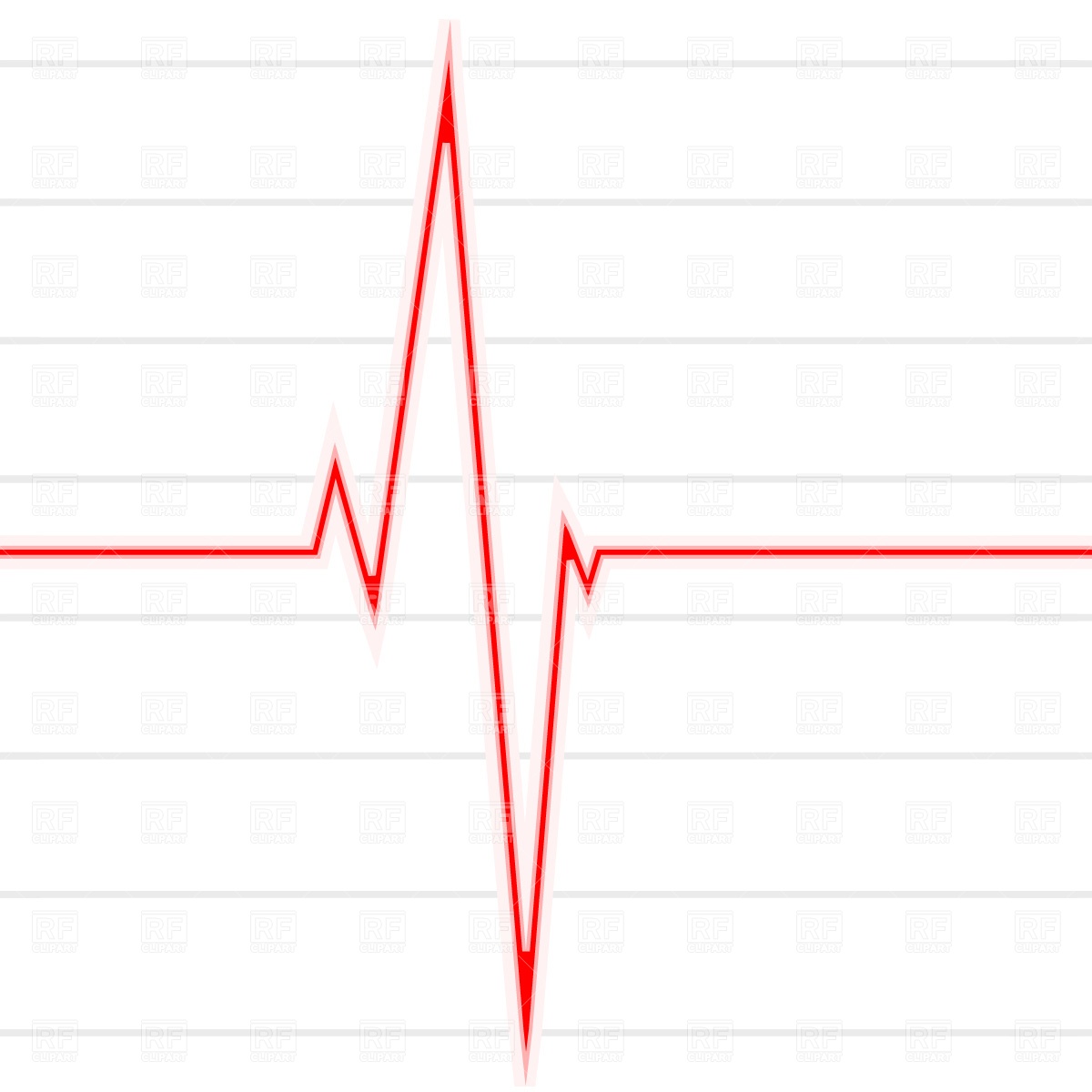 Heartbeat Monitor Clipart Pulse Clipart