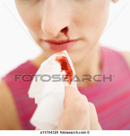 Nose Bleed Clip Art Search Pictures Photos