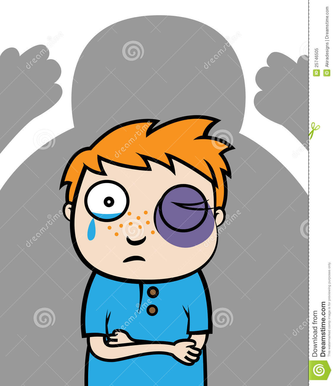 Cartoon Vector Illustration Of A Bullied Boy With Black Eye Or Victim