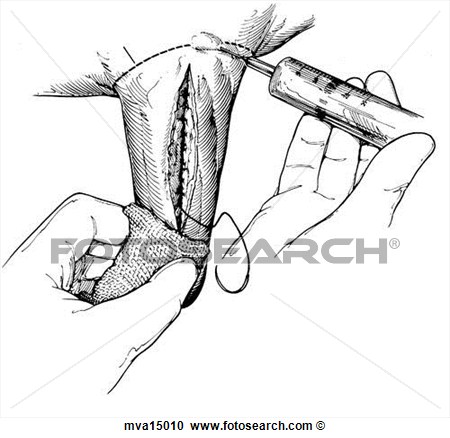 Illustration   Teat Laceration Bovine  Fotosearch   Search Clipart