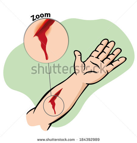 Laceration Clipart Stock Vector First Aid Wound With Blood 184392989    