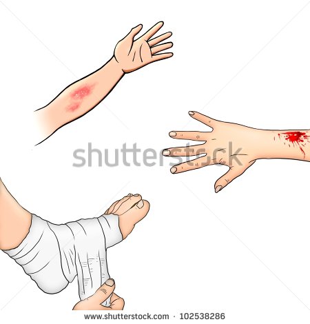 Go Back   Gallery For   Hand Injury Clipart
