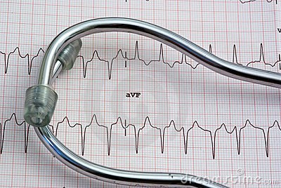 Close Up Of A Ekg Strip With Medical Tools On It