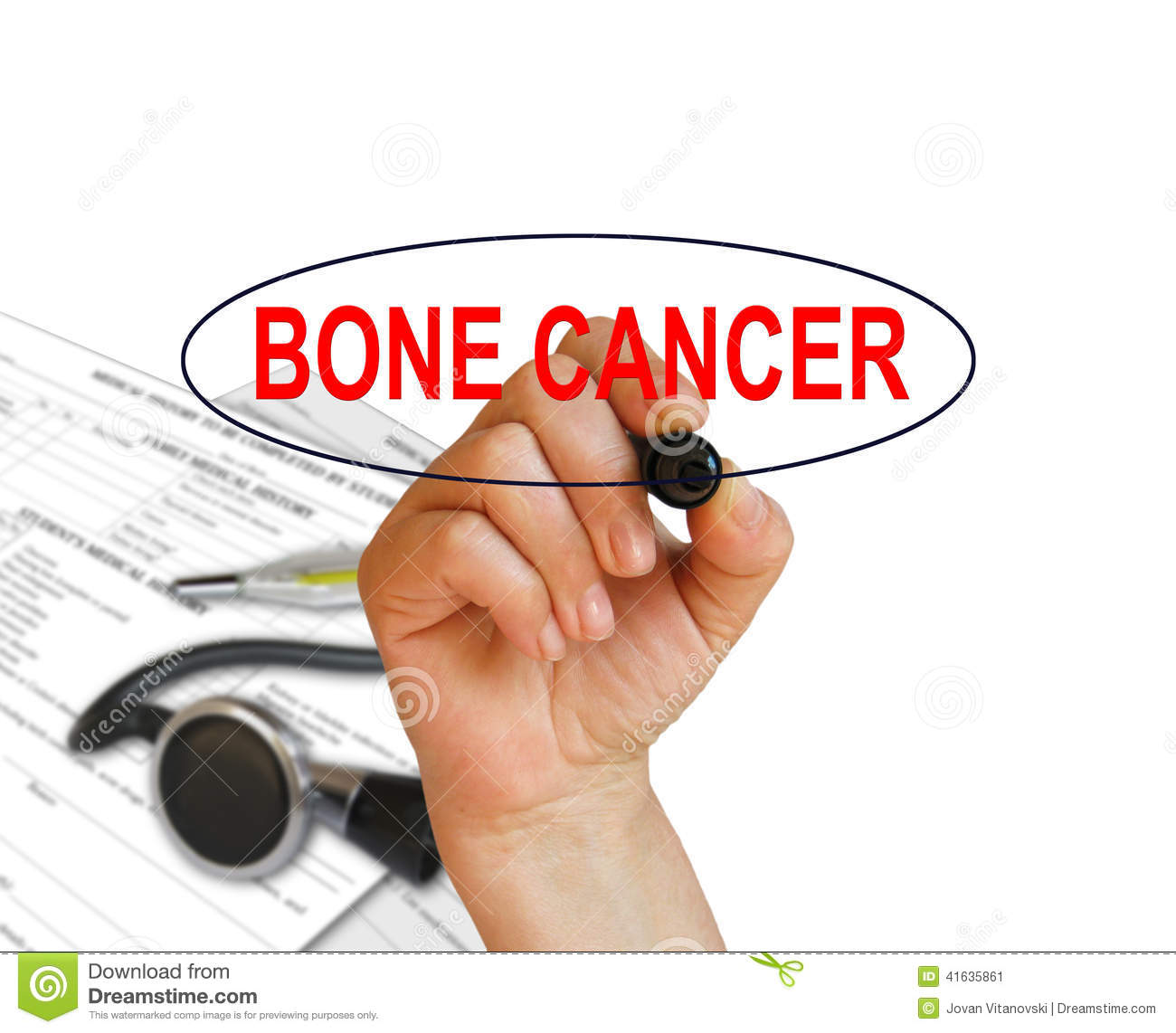 Bone Cancer Stock Illustration   Image  41635861