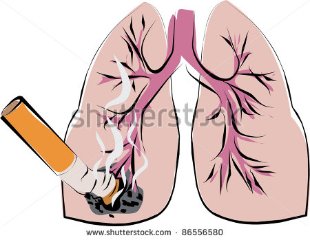 Lung Cancer Stock Vector 86556580   Shutterstock