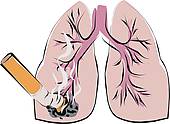 Smoker Lungs Stock Illustrations   Gograph