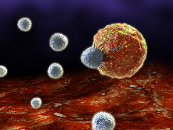 Cells Attacking A Cancer Cell